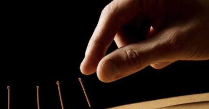 Acupuncture vs Dry Needling: What Patients Should Know